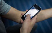 Ein paar scharfe Bilder reichen den Dermatologen oft für eine Diagnose. (Bild: Benjamin Manser)
