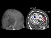 Während der Entscheidung im Hirnscanner: Je stärker die Gehirnbereiche im Parietalcortex und im Frontalcortex kommunizierten während die Testpersonen in ihrer Entscheidungsfreiheit eingeschränkt wurden, desto stärker war das Trotzverhalten. (Bild: Universität Bern)