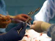 US-Forscher fanden heraus: Spender-Herzen von Drogentoten funktionieren ein Jahr nach der Transplantation genauso gut wie diejenigen von nach Schlaganfällen, Hirnblutungen oder Schusswunden Verstorbenen. (Bild: KEYSTONE/FR170882 AP/MOLLY RILEY)