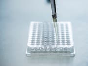 Genetische Untersuchungen beim Menschen werden gesetzlich neu geregelt. Die Bestimmungen sind grösstenteils unbestritten. (Bild: KEYSTONE/CHRISTIAN BEUTLER)