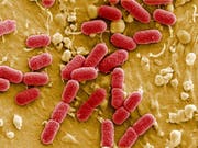 Ehec-Erreger auf Salatblättern haben in den USA bereits 120 Personen infiziert. (Bild: KEYSTONE/AP dapd/MANFRED ROHDE/HELMHOLTZ-ZENTRUM)