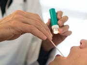 Je mehr Spezialärzte in der Schweiz praktizieren, umso höher sind die Gesundheitskosten. Der Bundesrat will dieser Entwicklung einen Riegel schieben. (Bild: KEYSTONE/CHRISTIAN BEUTLER)