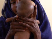 Eine Mutter mit ihrem unterernährten Kind in einer Klinik im Tschad. Insbesondere Kinder sind von der Hungersnot in mehreren Ländern der Sahel-Zone betroffen. (Bild: Keystone/AP/Rebecca Blackwell)