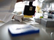 In Zukunft werden in der Schweiz HIV-Tests zur Eigenanwendung verkauft. (Bild: KEYSTONE/GAETAN BALLY)