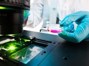 Die DNA-Reparaturmechanismen in Zellen wurden per Fluoreszenz-Mikroskopie untersucht. (Bild: Universität Bern/Conrad von Schubert)