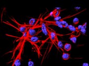   Neutrophil DNA networks (red). (Image: University of Bern / Institute of Pharmacology) 