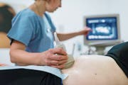 Bei einer Ultraschalluntersuchung wird das Trisomierisiko bestimmt. Liegt es höher als bei 1 : 1000, zahlen die Krankenkassen einen Bluttest, der Gewissheit bringt. (Bild: Christian Beutler/Keystone)
