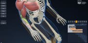 In der 3D-Computeranimation sollen Ärzte und Patienten verfolgen können, was bei einer Tetrahand-Operation im Körper der Betroffenen passiert. (Visualisierung PD)