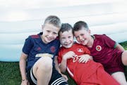 Kinder und Jugendliche mit Auffälligkeiten im Gesicht stehen im Mittelpunkt der Foto-Ausstellung «Schaut uns ruhig an». (Bild: Gabi Vogt)