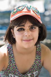 Wer einen Menschen mit einer Hautauffälligkeit trifft, sollte lieber direkt fragen als hinter seinem Rücken tuscheln. (Bild: Valerie Jaquet)