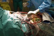 Jedes Jahr sterben bis zu 1700 Menschen wegen Fehlernim Spital. (Bild: Gaëtan Bally/Keystone)
