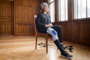 Michelle Gisin mit ihrem stabilisierten Bein am Dienstagnachmittag im Engelberger Hotel Bellevue. Bild: Boris Bürgisser (Engelberg, 29. Januar 2019)