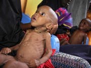 Ein unterernährtes Kind in einem Lager nach der Flucht vor Dürre in Somalia. (Bild: KEYSTONE/AP/FARAH ABDI WARSAMEH)