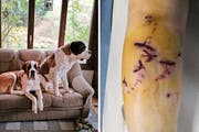Die beiden Bernhardiner sind mittlerweile beschlagnahmt worden. Eins der Tiere hatte in Gaissau eine Frau ins Bein gebissen und verletzt. (Bilder: pd)