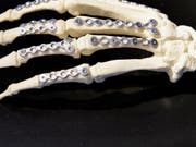 Legierungen aus Magnesium mit geringen Mengen Zink und Kalzium sind vom Körper abbaubar und eignen sich daher für Implantate wie Knochenschrauben und -platten. (Bild: ETH Zürich)
