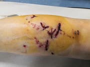 Diese Verletzungen trug eine Angestellte des China-Schiffs in Gaissau bei einer Attacke des Bernhardiners davon. (Bild: pd)
