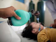 Ein an Masern erkrankte Kind wird in einem Spital in der philippinischen Hauptstadt Manila behandelt. (Bild: KEYSTONE/EPA/FRANCIS R. MALASIG)