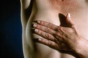 Neue Therapiestandards bei Brustkrebs würden vielen Frauen Vorteile bringen. Doch die Möglichkeiten werden noch zu wenig ausgeschöpft. (Bild: Getty)