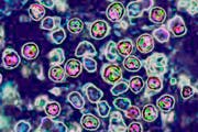 Schön bunt, aber gefährlich: Das hochansteckende Masern-Virus kann zu schweren Komplikationen und sogar zum Tod führen. (Bild: Getty)