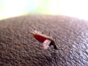 Moskitos wie Anopheles gambiae übertragen den Malariaparasiten bei der Blutmahlzeit. Ein neuer Diagnosetest könnte auch symptomlose Infektionen erkennen. (Bild: KEYSTONE/EPA/STEPHEN MORRISON)