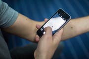 Könnte dieser Leberfleck gefährlich sein? Eine erste Einschätzung kann der Dermatologe auch online vornehmen. (Bild: Benjamin Manser)