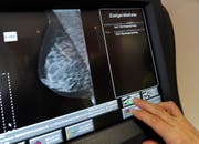 Mammografie-Aufnahme einer Brust zur Früherkennung von Tumoren. (Bild: Keystone)