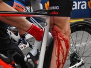 Das arg lädierte Knie, welches Tom Dumoulin im Giro zur Aufgabe zwang (Bild: KEYSTONE/EPA ANSA/ALESSANDRO DI MEO)