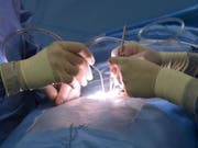Die Patienten eines Berner Chirurgen der mutmasslich in den Implantateskandal verwickelt ist, bekommen keinen Maulkorb verpasst. Das bernische Obergericht hat die Beschwerde einer Patientin gegen die Stillschweigepflicht gutgeheissen (Themenbild). (Bild: Keystone/APA/HELMUT FOHRINGER)
