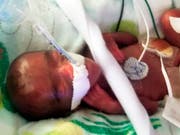 Das im Dezember 2018 in San Diego geborene Baby Saybie war bei der Geburt nur 245 Gramm leicht. Es wurde wegen Komplikationen nach nur 23 Wochen per Kaiserschnitt auf die Welt geholt. (Bild: KEYSTONE/AP Sharp HealthCare)
