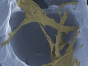 Im Gerüst des Polymerschaums finden Zellen - wie diese Fibroblasten - guten Halt, um neues Hautgewebe aufzubauen. (Kolorierte Mikroskopaufnahme, Vergrösserung 1200-fach) (Bild: Empa)