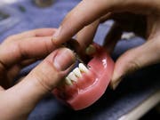 Neue GL-Mitglieder für Straumann: Der Implantatehersteller bekommt einen neuen Nordamerika-Chef (Archivbild). (Bild: KEYSTONE/MARTIN RUETSCHI)