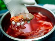 In Bulgarien ist ein illegaler Nieren-Händlerring aufgeflogen, der arme Menschen gegen Geld zur Organspende brachte. (Bild: KEYSTONE/EPA/BALAZS MOHAI)