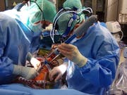 In einer weltweit erstmals notfallmässig durchgeführten Operation an einem Kind ersetzten Ärzte des Zürcher Unispitals rund 40 Zentimeter der Aorta durch eine Prothese. (Bild: Universitätsspital Zürich)