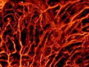 Insbesondere Blutgefässe lassen sich mit optoakustischer Bildgebung sichtbar machen. Die Methode kann aber auch Hirnaktivität messen, sowie bei der Diagnose von Brustkrebs und Hautkrankheiten helfen. (Bild: ETH Zürich / Daniel Razansky)