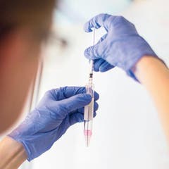 Vorbereitungen im Labor, um gut bewegliche Spermien zu isolieren. (Bild: Gaëtan Bally/Keystone)