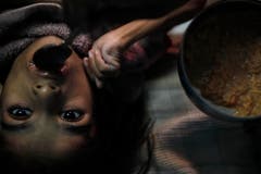 Die Katastrophe ist noch immer allgegenwärtig: Zahlreiche Kinder kamen und kommen mit Missbildungen zur Welt, wie beispielsweise Apeksha Malviya, deren Eltern dem Gift ausgesetzt waren. (Bild: Keystone)
