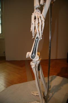 Implantate zur Stabilisierung des Skelettapparates, Carbonfaser, Polyetheretherketon. (Quelle: Textilmuseum) (Bild: Johannes Wey)