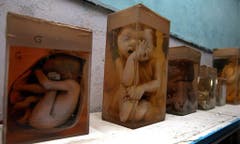 Mahnmal in Formaldehyd: missgebildete Föten lagern in einem Spital in Bhopal. (Bild: Keystone)