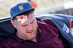 Christian Stucki mit einer blutenden Wunde auf der Stirn. (Bild: Philipp Schmidli)