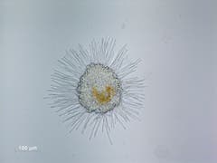 Das Mikrofoto des neu entdeckten Buchenpathogens, eines parasitären Pilzes, der die Buchenblätter befällt und den Baum schwächt. (Bild: PD/Ottmar Holdenrieder)