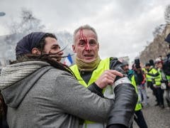Mehrere Menschen wurden verletzt. Einer erlitt eine schwere Handverletzung. (Bild: KEYSTONE/EPA/CHRISTOPHE PETIT TESSON)