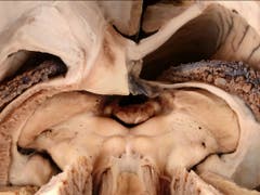 Diese Perspektive aufs Gehirn bekommen sonst nur Hirnchirurginnen und -chirurgen zu sehen. Das Siegerbild der Kategorie «Forschungsobjekt» entstand allerdings im Zuge einer anatomischen Studie, nicht während einer OP. (Bild: Kevin Akeret (Universitätsspital Zürich))