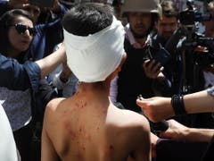 Mindestens 65 Menschen wurden bei der Explosion einer Autobombe in Kabul verletzt, manche Quellen berichten bereits von 10 Toten. (Bild: KEYSTONE/EPA/JAWAD JALALI)
