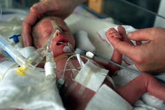 Das erste Bild: Annelou war mit 1050 Gramm das leichteste der vier Babys. Alle mussten als Frühgeburt noch eine Weile im Spital bleiben. (Archivbild LZ)