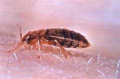 Bettwanze: ca. 3,8 – 5,5 mm gross, saugt Blut, lebt in Ritzen im Zimmer. (Bild: Wikipedia)