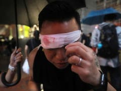 Ein Protestierender hat eine Augenbinde angezogen, um so seine Solidarität mit einer Frau zu zeigen, die bei den Protesten am Auge verletzt worden war. (Bild: KEYSTONE/EPA/VIVEK PRAKASH)
